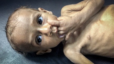 Barn frá Jemen